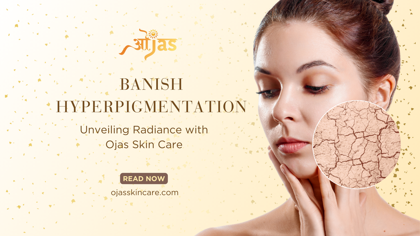 Banish Hyperpigmentation Unveiling Radiance With Ojas Skin Care