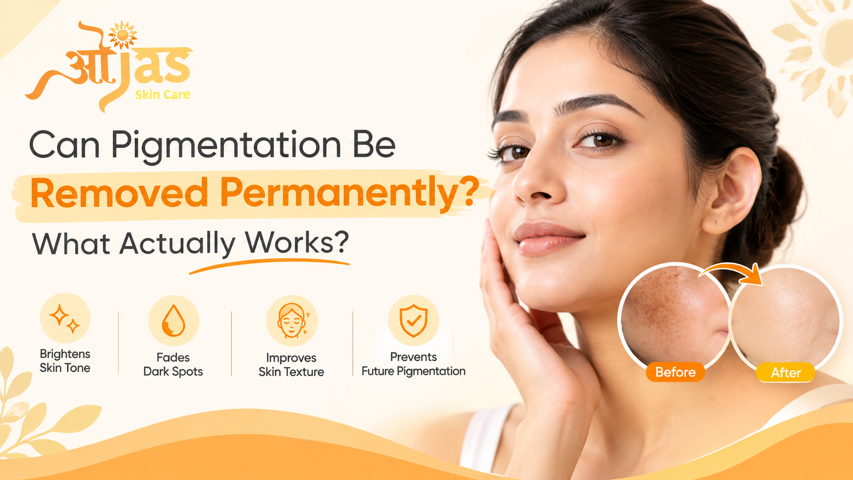 Best Pigmentation Removed Treatment in Noida