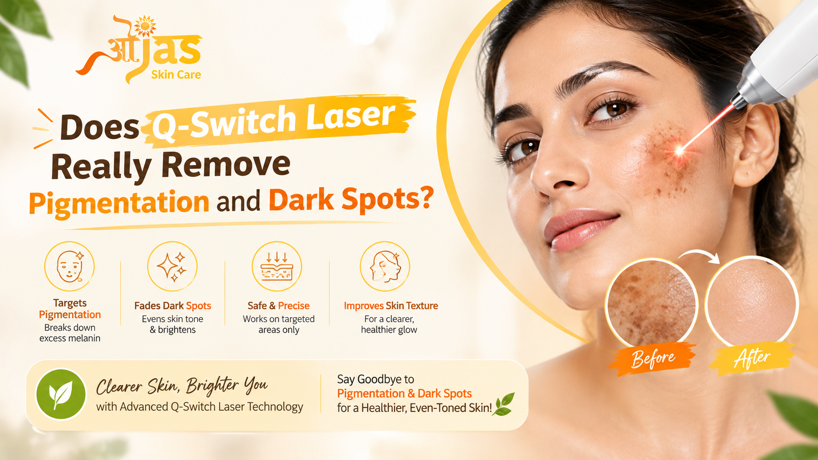 Q Switch Laser Treatment in Noida