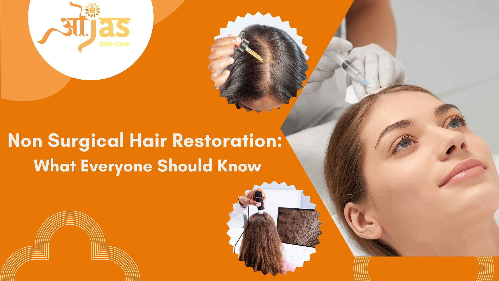 Non Surgical Hair Restoration: What Everyone Should Know