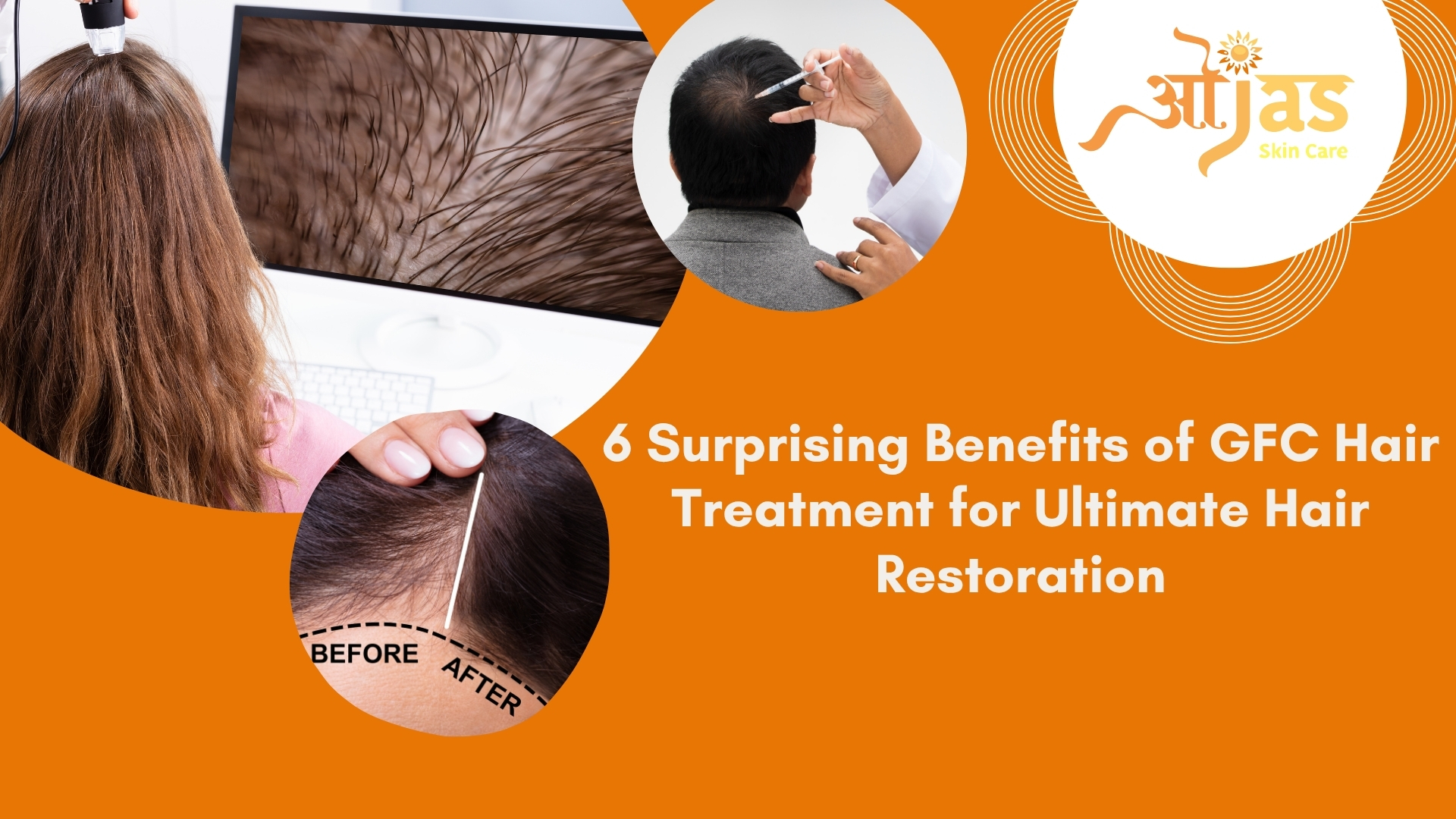 6 Surprising Benefits of GFC Hair Treatment for Ultimate Hair Restoration