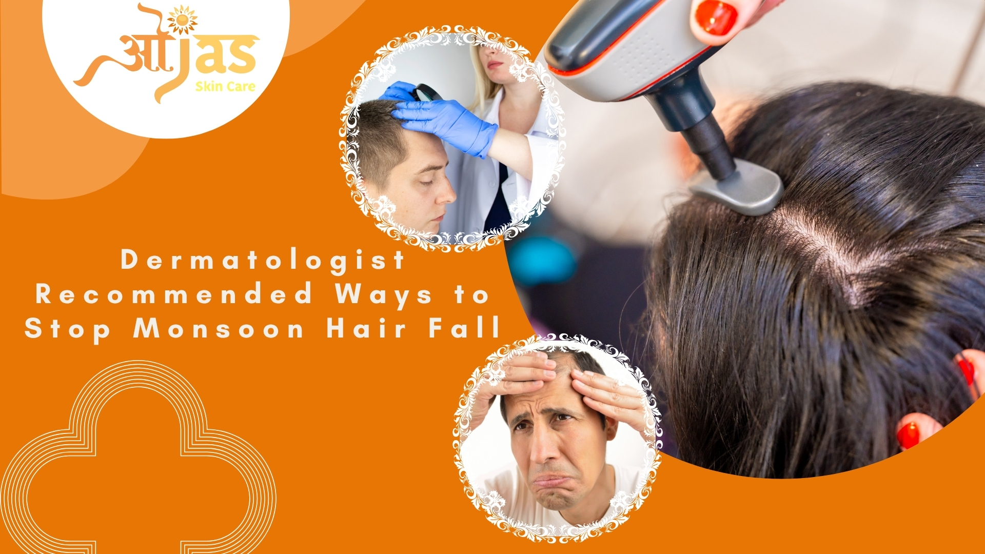 Dermatologist Recommended Ways to Stop Monsoon Hair Fall