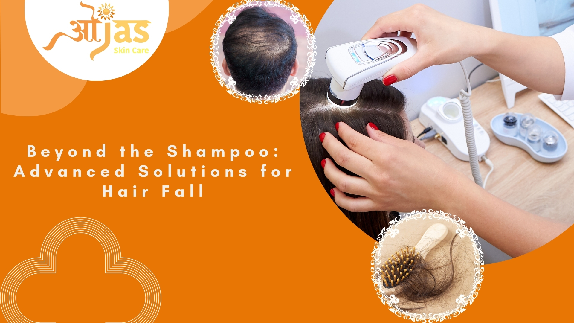 Beyond the Shampoo: Advanced Solutions for Hair Fall
