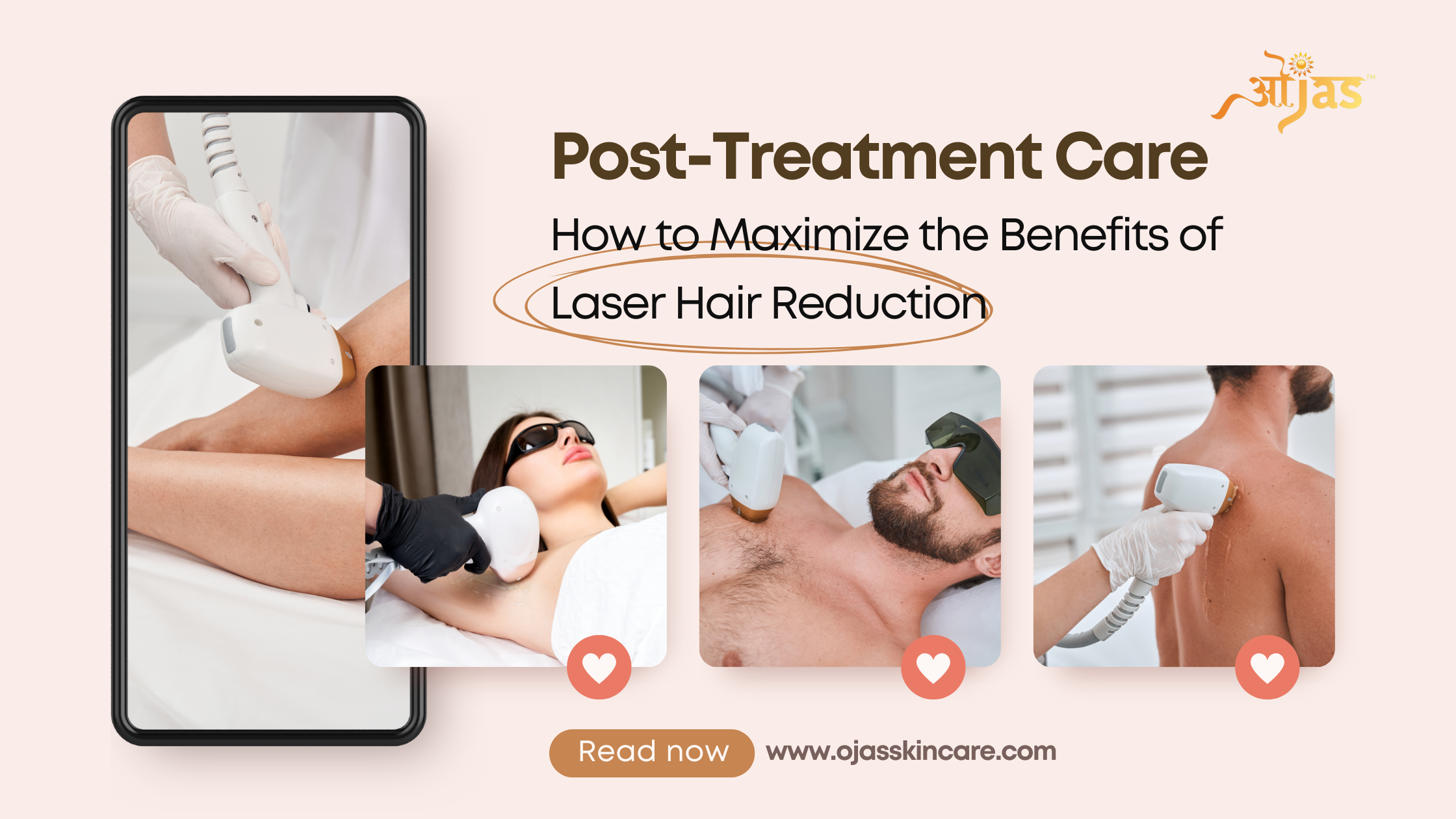 Post-Treatment Care: How to Maximize the Benefits of Laser Hair Reduction