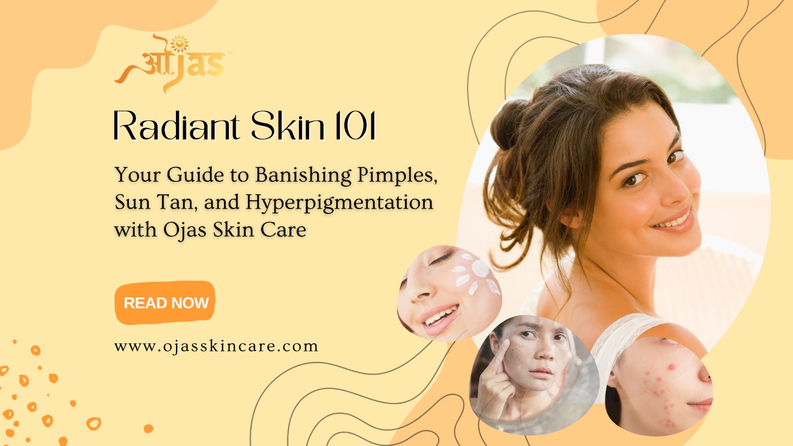 Radiant Skin 101 Your Guide To Banishing Pimples, Sun Tan, And Hyperpigmentation