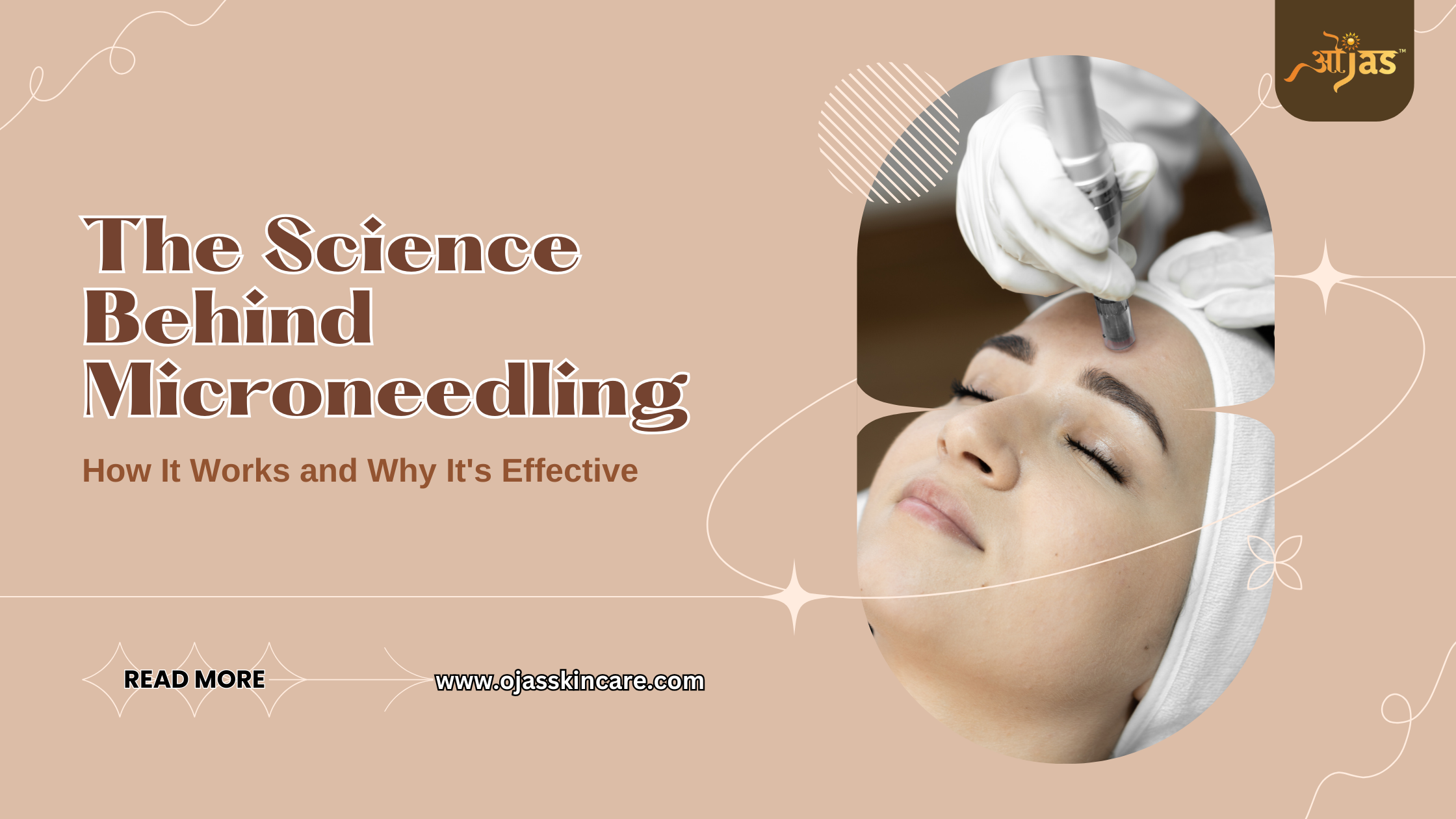 The Science Behind Microneedling: How It Works and Why It’s Effective