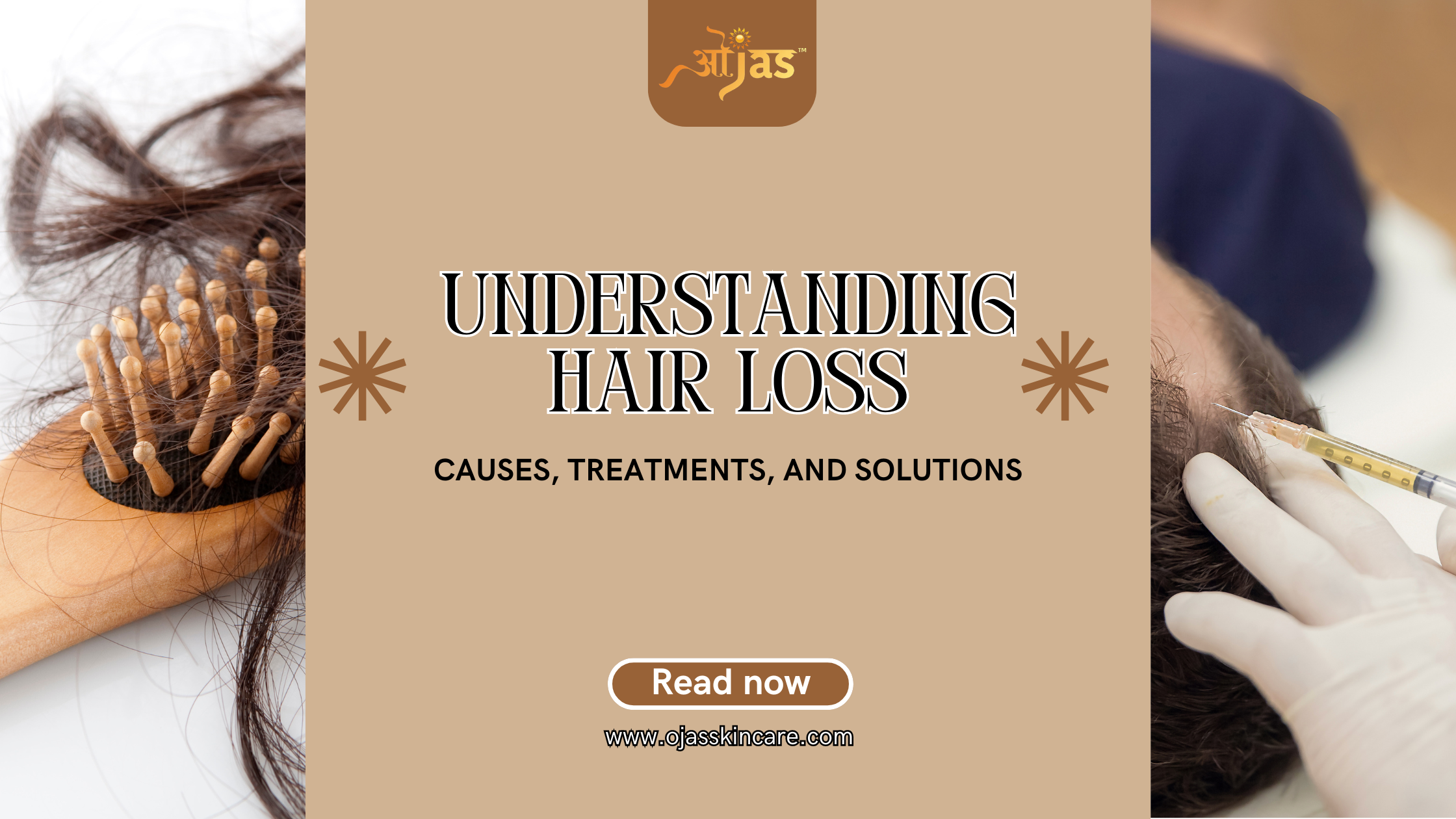 Understanding Hair Loss: Causes, Treatments, and Solutions