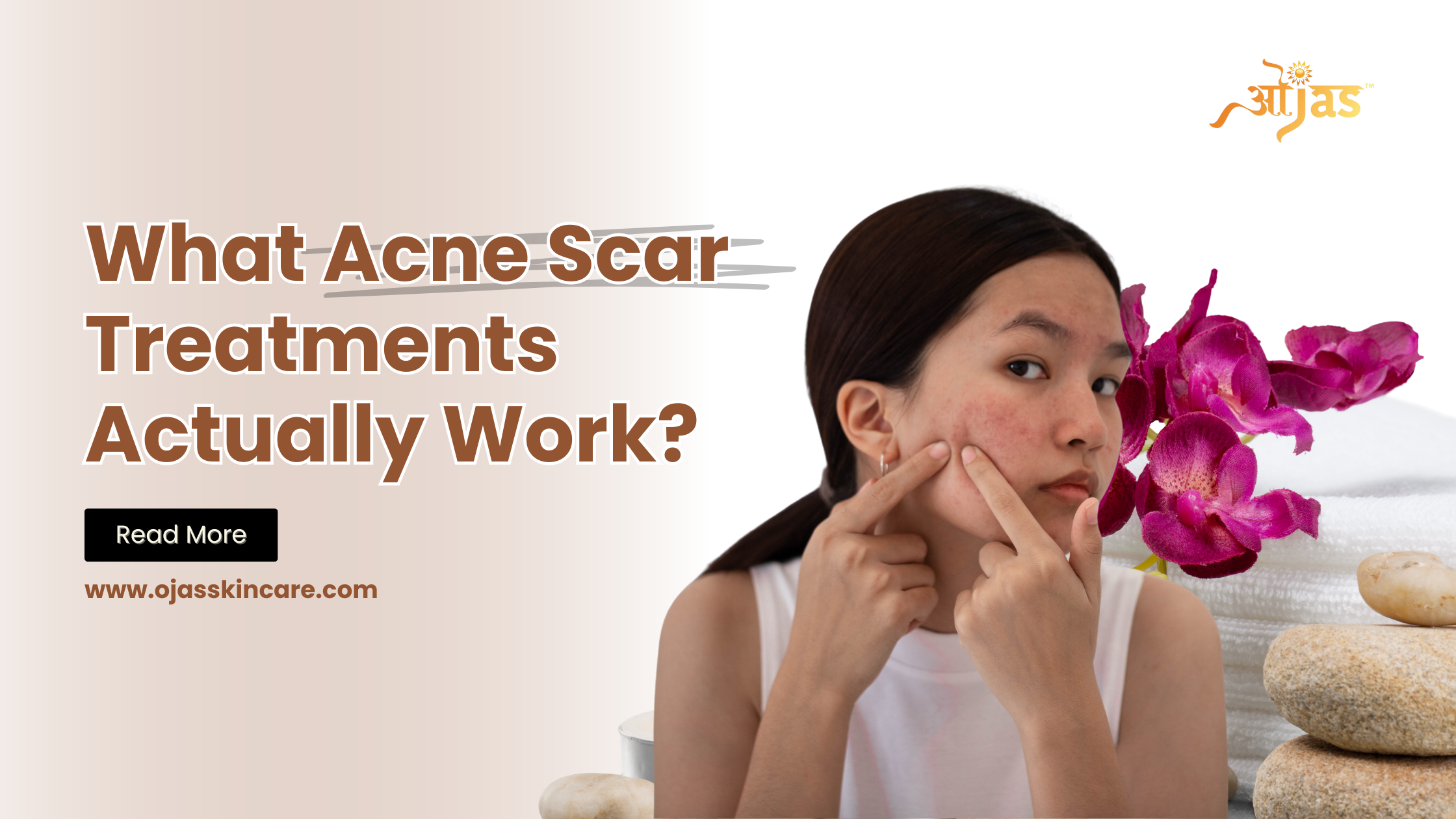 What Acne Scar Treatments Actually Work?